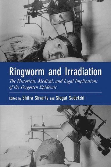 bokomslag Ringworm and Irradiation