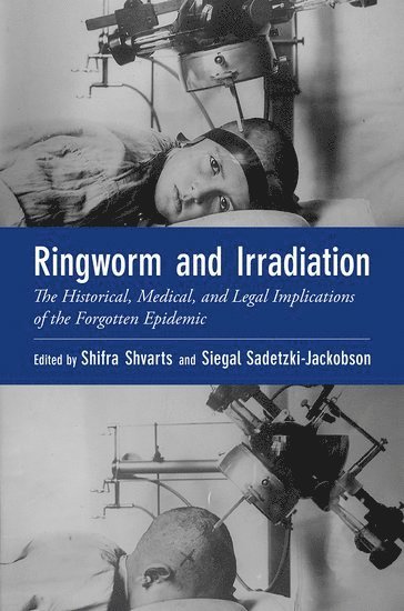 Shifra Shvarts, Siegal Sadetzki - Ringworm and Irradiation, Häftad