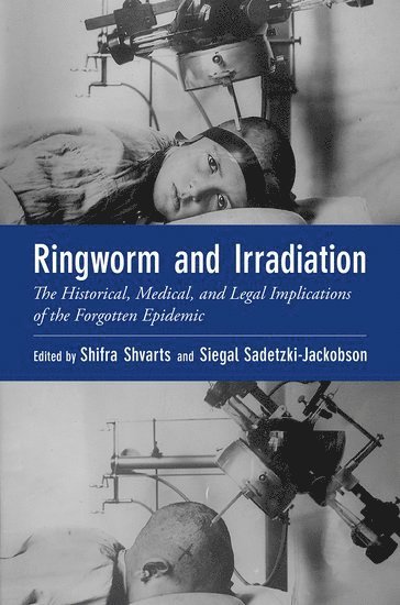 Ringworm and Irradiation 1