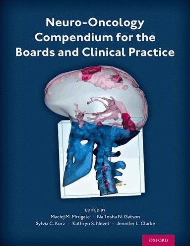 bokomslag Neuro-Oncology Compendium for the Boards and Clinical Practice