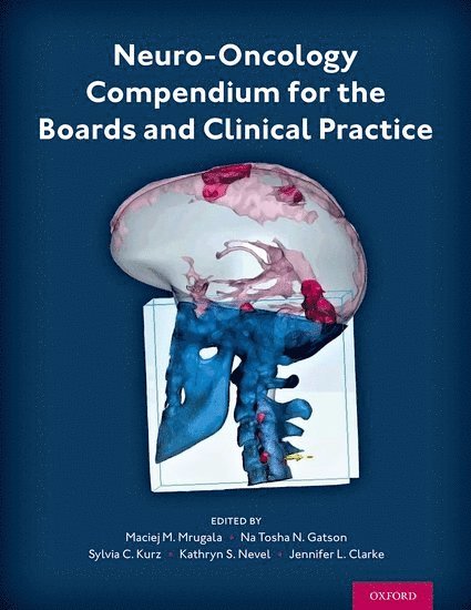 Neuro-Oncology Compendium for the Boards and Clinical Practice 1