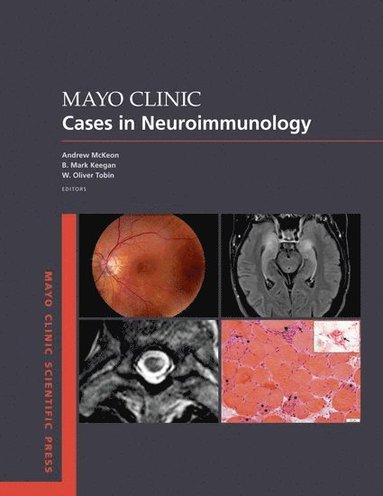 bokomslag Mayo Clinic Cases in Neuroimmunology