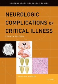 bokomslag Neurologic Complications of Critical Illness