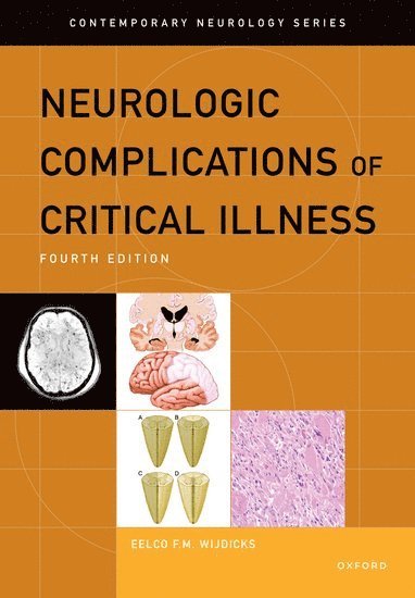 bokomslag Neurologic Complications of Critical Illness