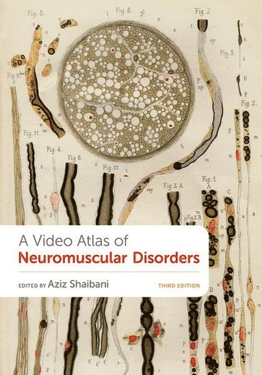 bokomslag A Video Atlas of Neuromuscular Disorders