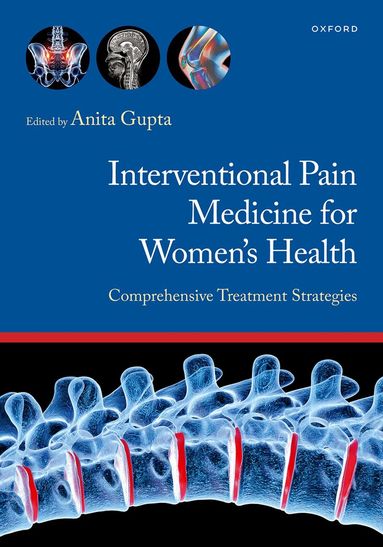 Anita Gupta - Interventional Pain Medicine for Women's Health, Häftad