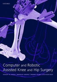 bokomslag Computer and Robotic Assisted Hip and Knee Surgery