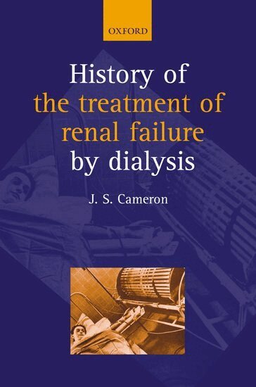 J Stewart Cameron - A History of the Treatment of Renal Failure by Dialysis, Inbunden
