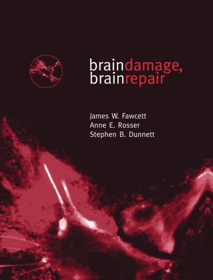 Brain Damage, Brain Repair 1