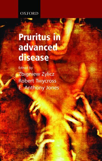 Zbigniew Zylicz, Robert Twycross, E Anthony Jones - Pruritus in Advanced Disease, Häftad