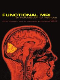 bokomslag Functional Magnetic Resonance Imaging