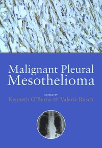 bokomslag Malignant Pleural Mesothelioma
