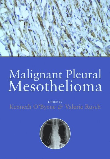 Malignant Pleural Mesothelioma 1