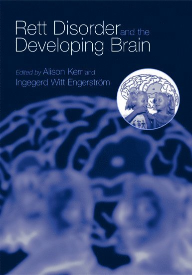 Rett Disorder and the Developing Brain 1