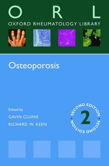 Gavin Clunie, Richard W. Keen - Osteoporosis, Häftad