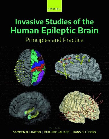 Samden D. Lhatoo, Philippe Kahane - Invasive Studies of the Human Epileptic Brain: Principles and Practice, Inbunden