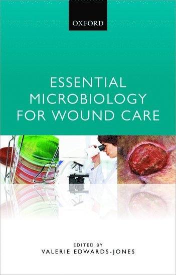 Essential Microbiology for Wound Care 1