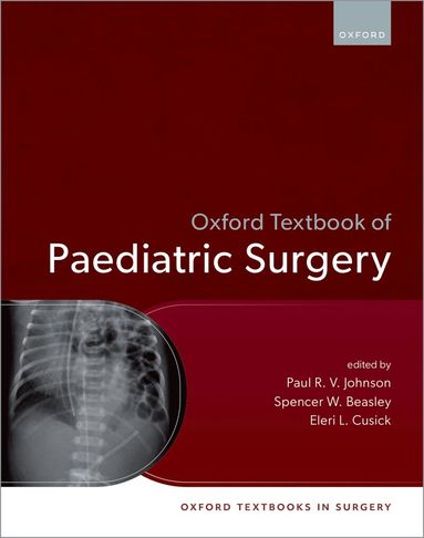 Paul R. V. Johnson, Spencer W. Beasley, Eleri Cusick - Oxford Textbook of Paediatric Surgery, Inbunden