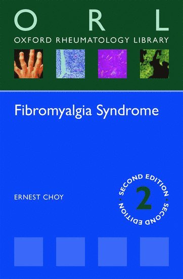 bokomslag Fibromyalgia Syndrome