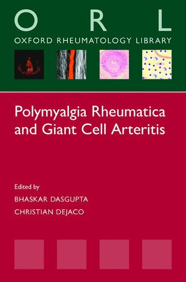 Bhaskar Dasgupta, Christian Dejaco, UK) Dasgupta, Bhaskar (Head of Rheumatology, Head of Rheumatology, Department of Rheumatology, Southend University Hospital, Department of Rheumatology, Austria) Dejaco, Christian (Assistant Professor, Assistant Professor, Department of Rheumatology and Immunology, University of Graz - Polymyalgia Rheumatica and Giant Cell Arteritis, Häftad