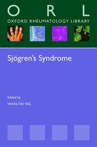 bokomslag Sjgren's Syndrome