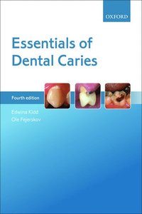 bokomslag Essentials of Dental Caries