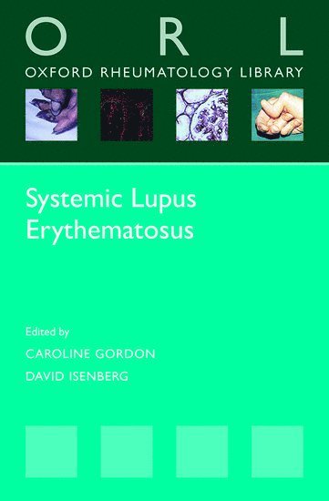 bokomslag Systemic Lupus Erythematosus