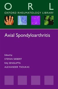 bokomslag Axial Spondyloarthritis
