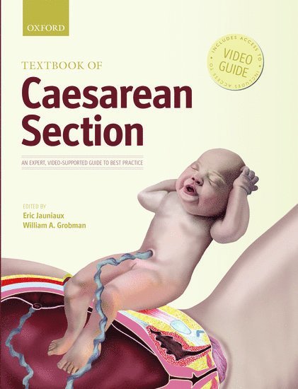 Eric Jauniaux, William Grobman, UK) Jauniaux, Eric (Professor of Obstetrics and Fetal Medicine, Professor of Obstetrics and Fetal Medicine, Institute for Women's Health, University College London, London, USA) Grobman, William (Professor of Obstetrics and Gynaecology-Maternal Fetal Medicine, Professor of Obstetrics and Gynaecology-Maternal Fetal Medicine, Center for Health Care Studies, Institute for Public Health and Medicine and Preventative Medicine, Northwestern University, Chicago, Illinois - Textbook of Caesarean Section, Inbunden