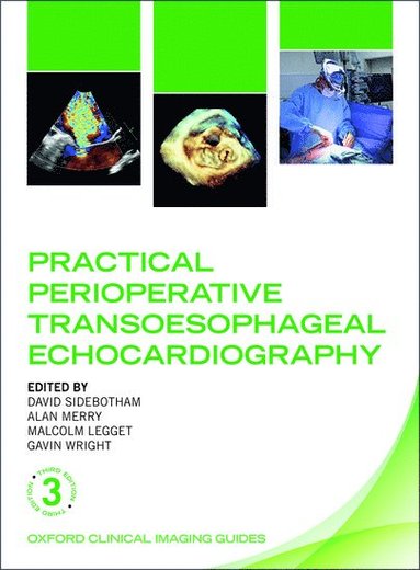 bokomslag Practical Perioperative Transoesophageal Echocardiography