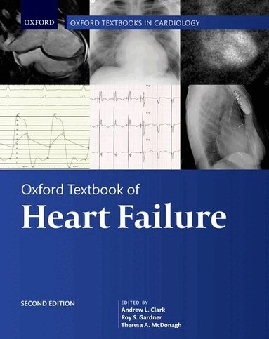 Andrew Clark, Roy Gardner, Theresa McDonagh - Oxford Textbook of Heart Failure, Inbunden