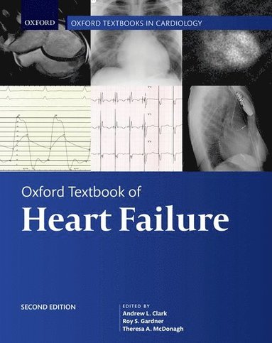 bokomslag Oxford Textbook of Heart Failure