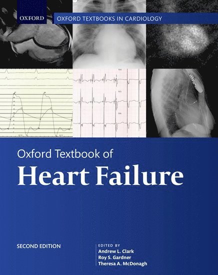 Andrew Clark, Roy Gardner, Theresa McDonagh, UK) Clark, Andrew (Castle Hill Hospital, Hull York Medical School, Kingston-upon-Hull, UK) Gardner, Roy (Scottish National Advanced Heart Failure Service, Golden Jubilee National Hospital, Clydebank, UK) McDonagh, Theresa (Department of Cardiology, King's College Hospital, London, Andrew L. Clark, Roy S. Gardner, Andrew L Clark, Roy S Gardner, Theresa A McDonagh - Oxford Textbook of Heart Failure, Inbunden