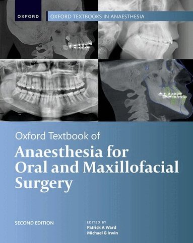 Patrick A. Ward, Michael G. Irwin - Oxford Textbook of Anaesthesia for Oral and Maxillofacial Surgery, Inbunden