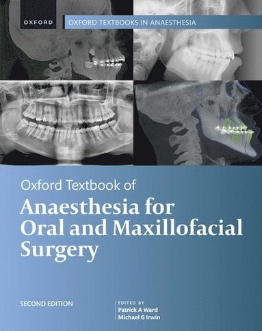 bokomslag Oxford Textbook of Anaesthesia for Oral and Maxillofacial Surgery