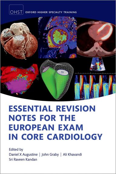 Daniel X. Augustine, John Graby - Essential Revision notes for the European Exam in Core Cardiology, Häftad