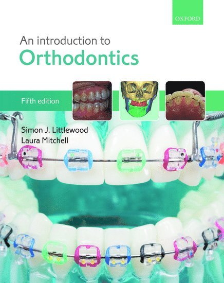 Simon J. Littlewood, Laura Mitchell, UK) Littlewood, Simon J. (Consultant Orthodontist and Specialty Lead, Consultant Orthodontist and Specialty Lead, St. Luke's Hospital, Bradford, UK, Honorary Senior Clinical Lecturer, University of Leeds, UK) Mitchell, Laura (Previously Consultant Orthodontist, Previously Consultant Orthodontist, Bradford Teaching Hospitals NHS Foundation Trust, Honorary Senior Clinical Lecturer, Leeds University, Simon J Littlewood - An Introduction to Orthodontics, Häftad