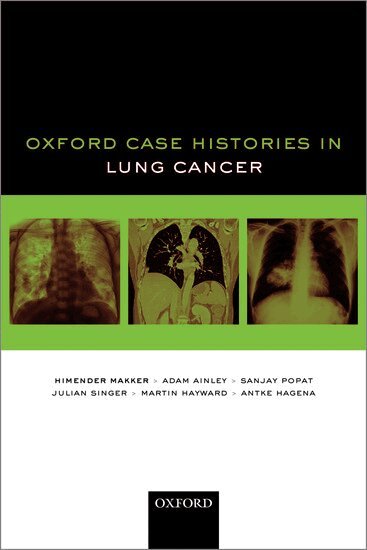 Himender K. Makker, Adam Ainley, Sanjay Popat, Julian Singer, Martin Hayward, Antke Hagena - Oxford Case Histories in Lung Cancer, Häftad