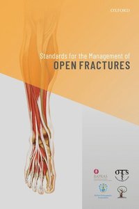 bokomslag Standards for the Management of Open Fractures