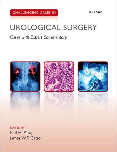 Karl Pang, James Catto - Challenging Cases in Urological Surgery, Häftad