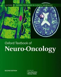 bokomslag Oxford Textbook of Neuro-Oncology