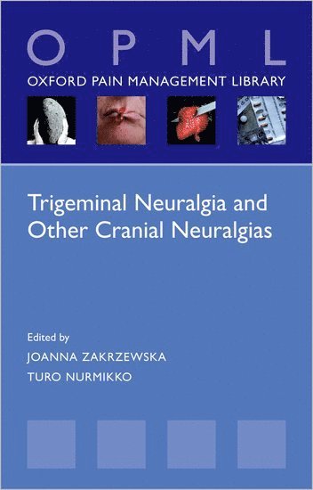 Trigeminal Neuralgia and Other Cranial Neuralgias 1