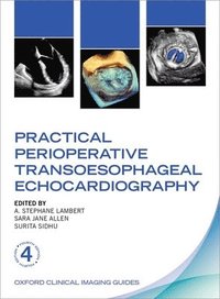 bokomslag Practical Perioperative Transoesophageal Echocardiography