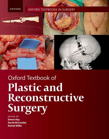 Simon Kay, Daniel Wilks - Oxford Textbook of Plastic and Reconstructive Surgery, Häftad