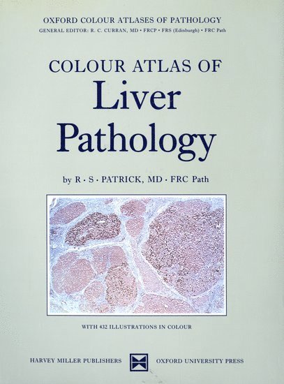 Colour Atlas of Liver Pathology