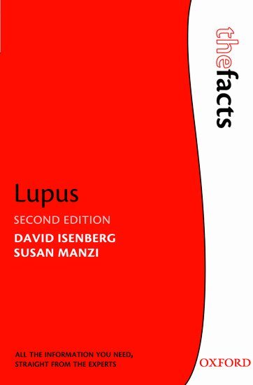 David Isenberg, Susan Manzi - Lupus, Häftad