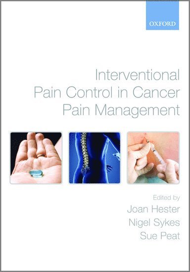 Interventional Pain Control in Cancer Pain Management 1