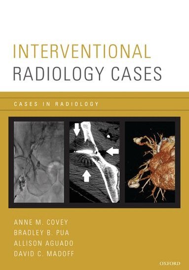 Anne M. Covey, Bradley P. Pua, Allison Aguado, David C. Madoff, Anne M. Covey, Bradley Pua, Allison Aguado - Interventional Radiology Cases, Häftad
