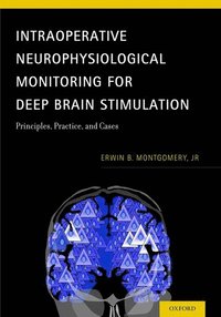 bokomslag Intraoperative Neurophysiological Monitoring for Deep Brain Stimulation