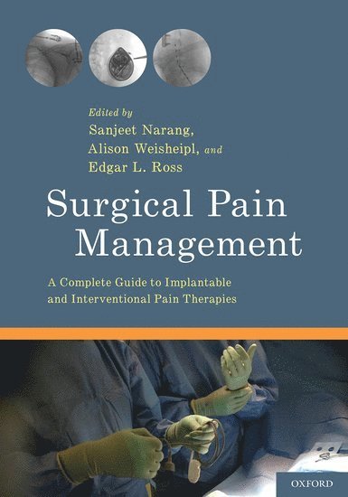 Surgical Pain Management 1